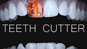Teeth Cutter
