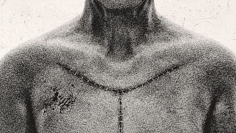 Autopsy Simulator Game