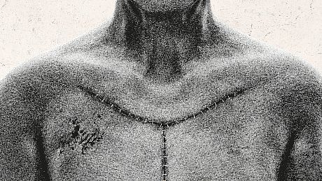 Autopsy Simulator Game