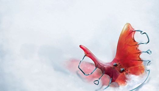 The Suicide Of Rachel Foster