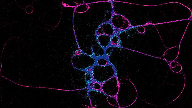 PHYSARUM: Slime Mold Simulator