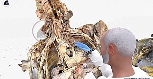 MEDICALHOLODECK. Surgery, Anatomy, Medicine, Education, and DICOM Imaging in VR. For Medical Students, Nurses, Doctors and Surgeons.