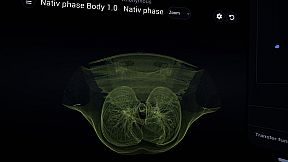 Bodyscope