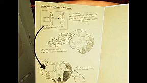 Marion Surgical Robot Game