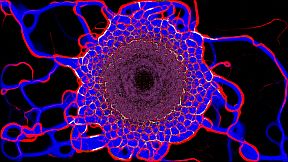 PHYSARUM: Slime Mold Simulator