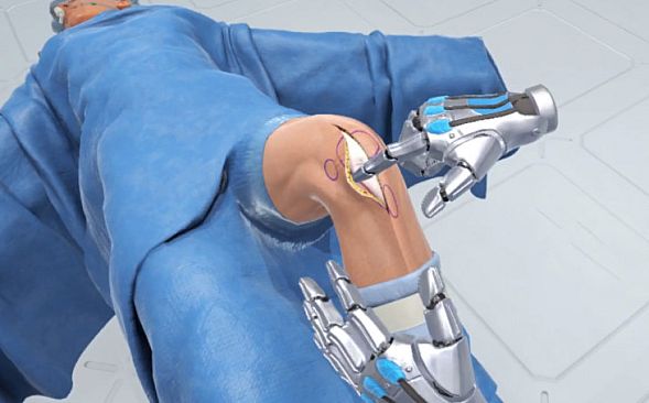 Ghost Productions: Wraith VR Total Knee Replacement Surgery Simulation