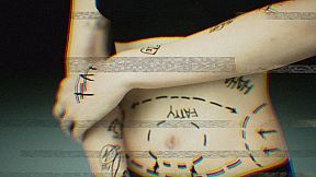 BrokenLore: UNFOLLOW