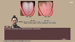 中医模拟传承人