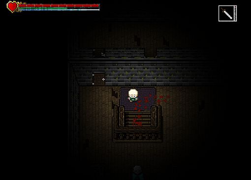 Snails Have Skeletons