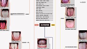 中医模拟传承人