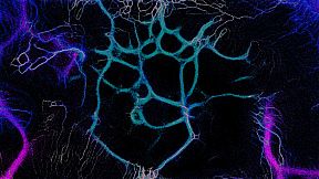 PHYSARUM: Slime Mold Simulator