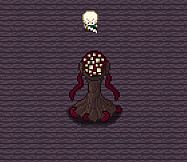 Snails Have Skeletons