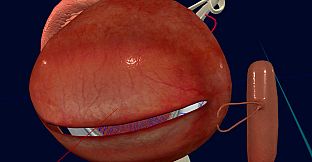 眼睛（眼球）结构研究