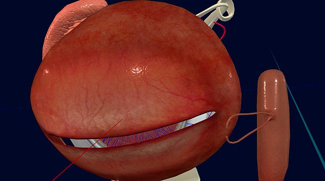 眼睛（眼球）结构研究