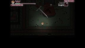 Snails Have Skeletons