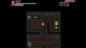 Snails Have Skeletons