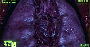 Negative Atmosphere: Emergency Room Prototype