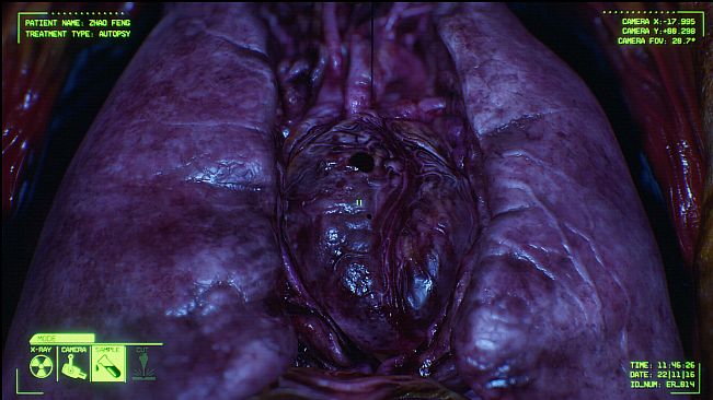 Negative Atmosphere: Emergency Room Prototype