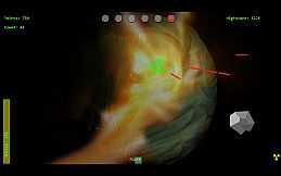 orbital defence unit