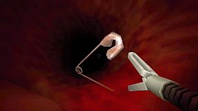 Revenge Of The Colon