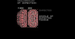 Symptoms of Infection