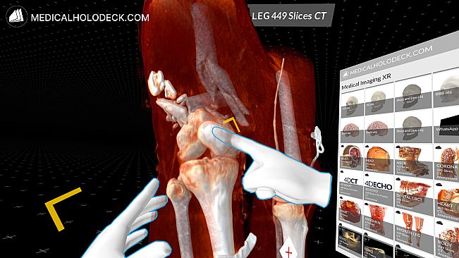 MEDICALHOLODECK. Surgery, Anatomy, Medicine, Education, and DICOM Imaging in VR. For Medical Students, Nurses, Doctors and Surgeons.