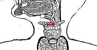 Let's Find Cats Inside the Human Body