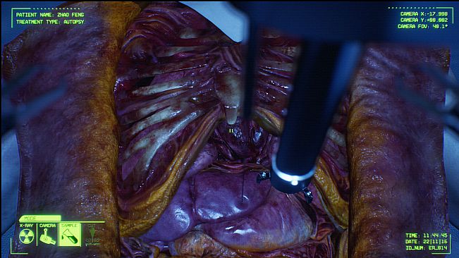 Negative Atmosphere: Emergency Room Prototype