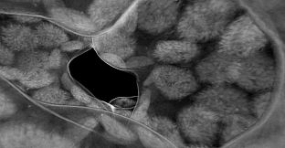 Tomography VR