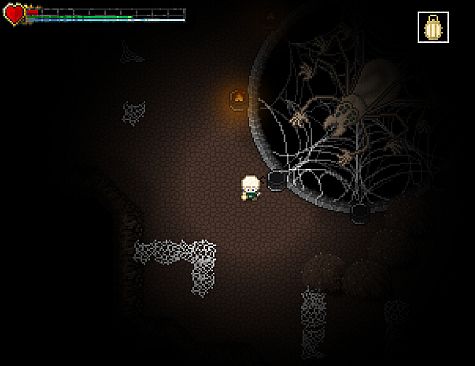 Snails Have Skeletons