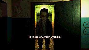 Hi! These Are Your Eyeballs