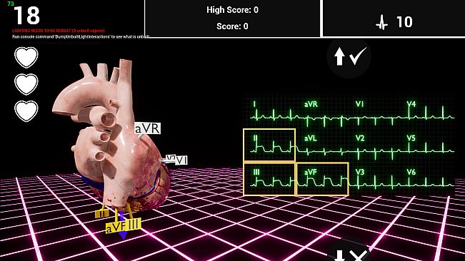 ER-cade