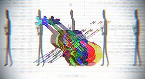 堡外就医 / Can I Buy You A Cheeseburger?